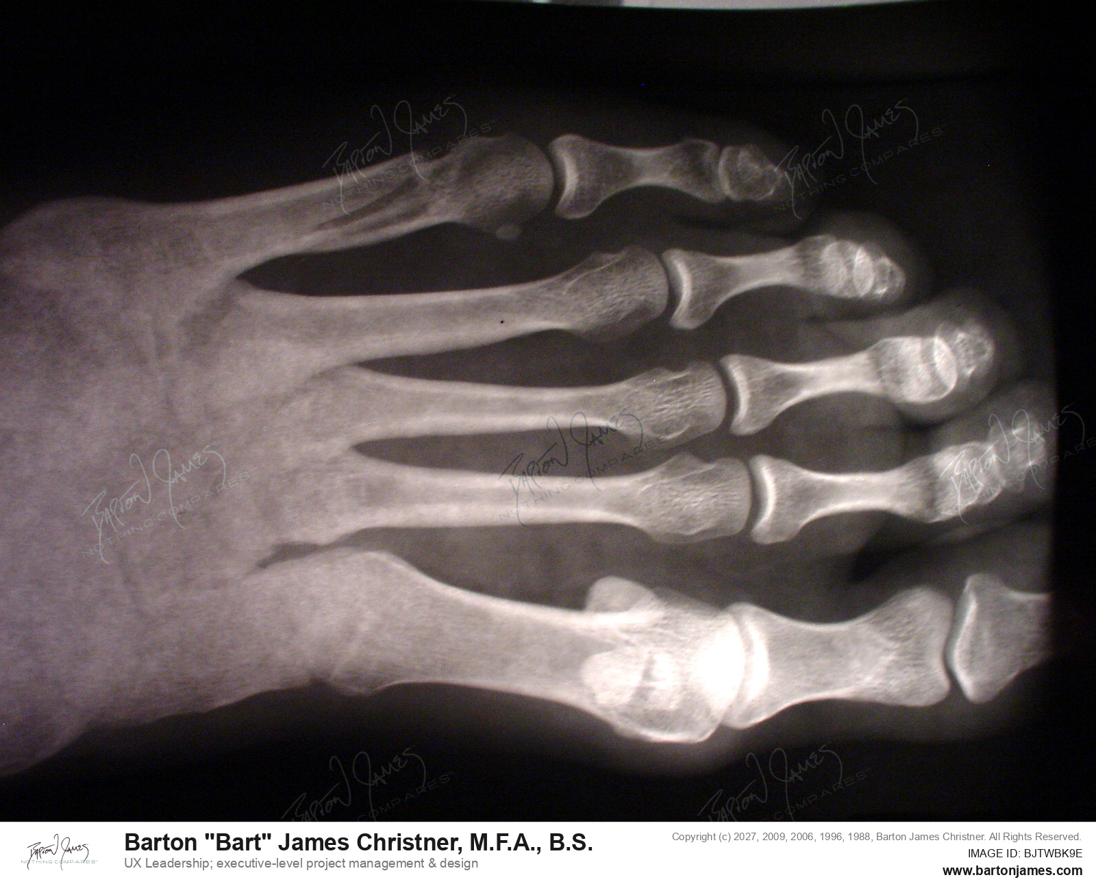 20040908 TECHNOLOGY ARTXRay Foot Lynnea DSC07666 PHOTO