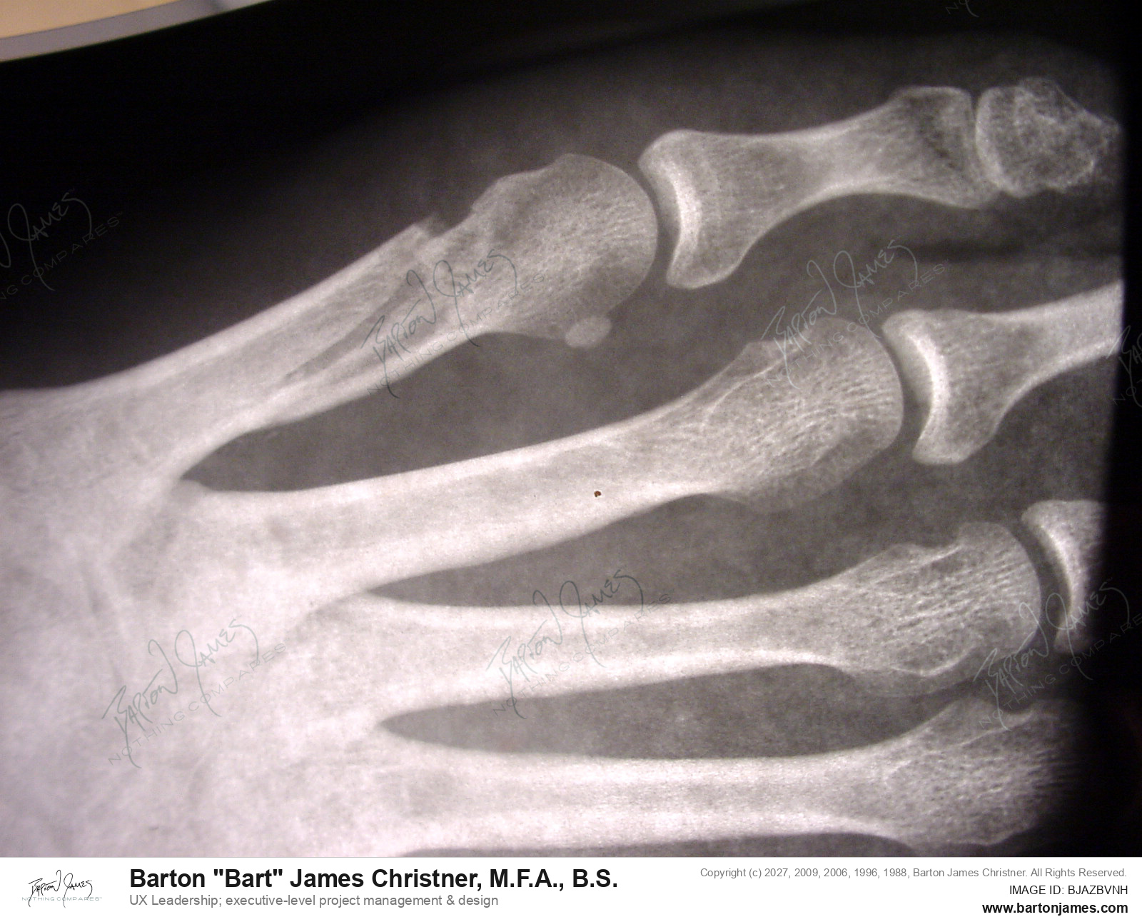 20040908 TECHNOLOGY ARTXRay Foot Lynnea DSC07668 PHOTO